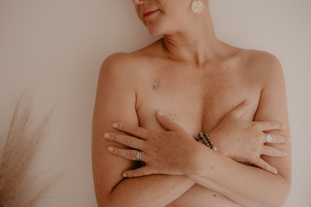 cicatrice cancer du sein